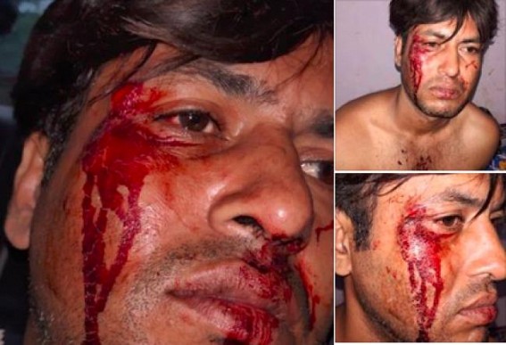 Tripura young artist Raja Hossain beaten by BJP cadres as a part of celebrating Poll-Victory